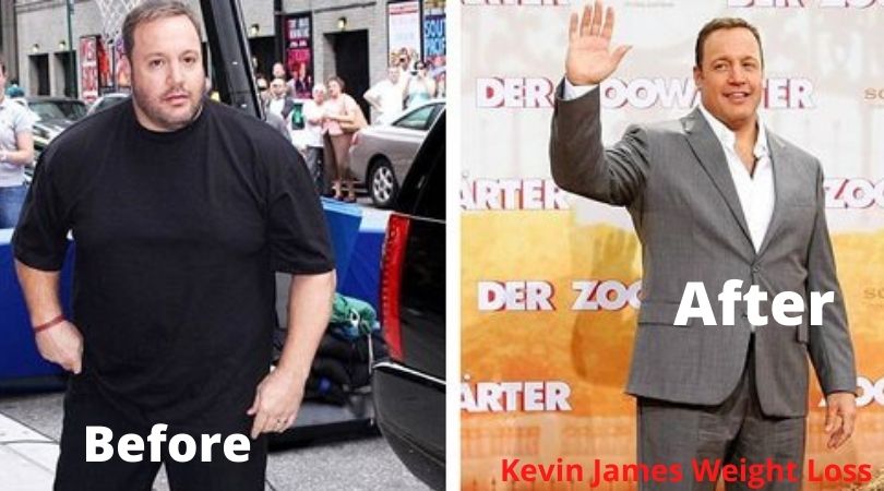 Kevin James weight loss