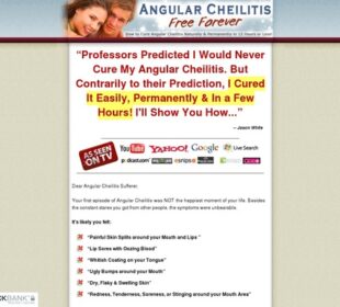 Angular Cheilitis Free Forever - How to Cure Angular Cheilitis Naturally & Permanently in 12 Hours or Less