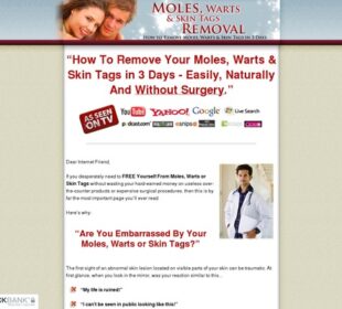 Moles, Warts & Skin Tags Removal - How To Safely & Permanently Remove Moles, Warts & Skin Tags