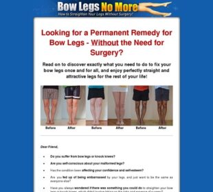Bow Legs No More - How to Straighten Your Legs Without Surgery!