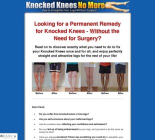 Knocked Knees No More - How to Straighten Your Legs Without Surgery!