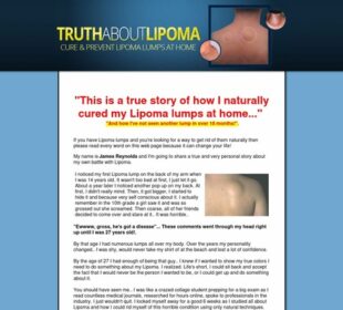 Truth About Lipoma by James Reynolds